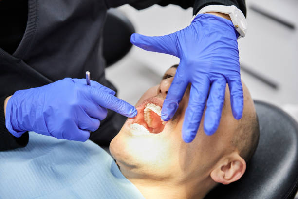 Best Walk-In Emergency Dental Services in Mount Hermon, CA
