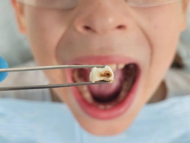 Best Emergency Orthodontic Repairs in Mount Hermon, CA